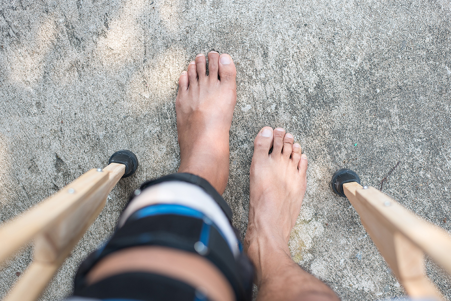 What To Do If You Are Injured On Holiday